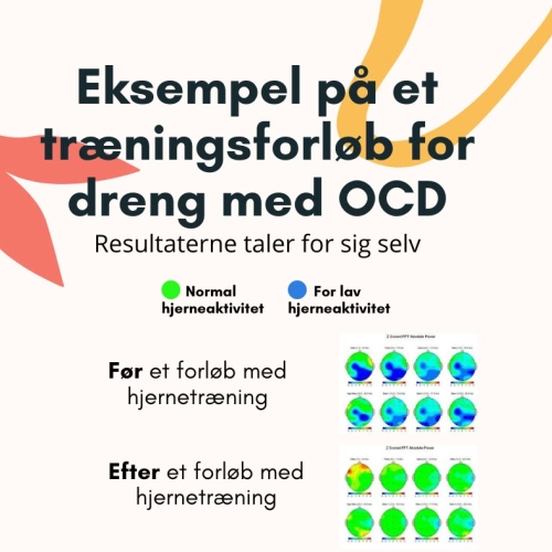 Hjælp til OCD